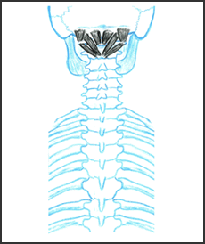 Posterior Neck Muscles